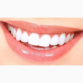 Профессиональное отбеливание зубов с помощью системы Beyond Polus